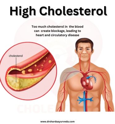 The Best Treatment for High Cholesterol