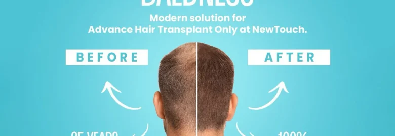 New Touch – Hair Transplant Clinic Ahmedabad