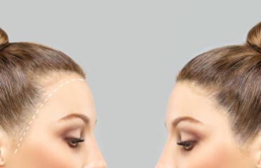 Hair Transplant Cost in Saudi Arabia 2026